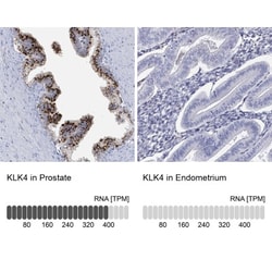 Kallikrein 4/Prostase/EMSP1 Antibody, Novus Biologicals:Antibodies:Primary
